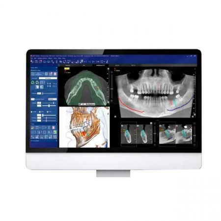 rom9zjubjq8wfibl2fuairqw1z7jaub3