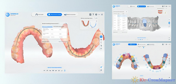 Интраоральный сканер Aoralscan 3 Light, Shining 3D