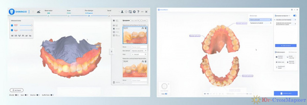 Интраоральный сканер Aoralscan 3 Light, Shining 3D