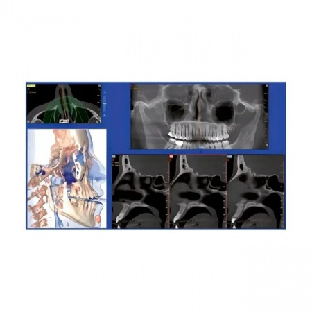 gij3w6ydlhbn1zpt18nmfn525dt6posd